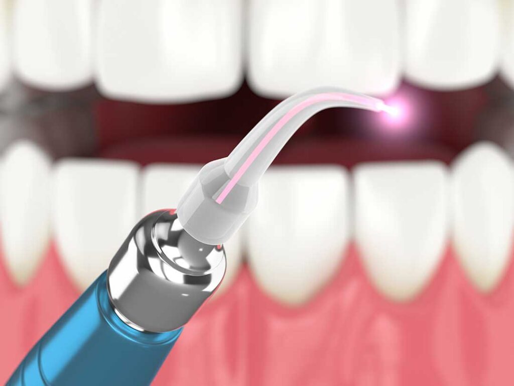 A dental hygienist cleaning a patient's teeth in a bright, modern dental office.